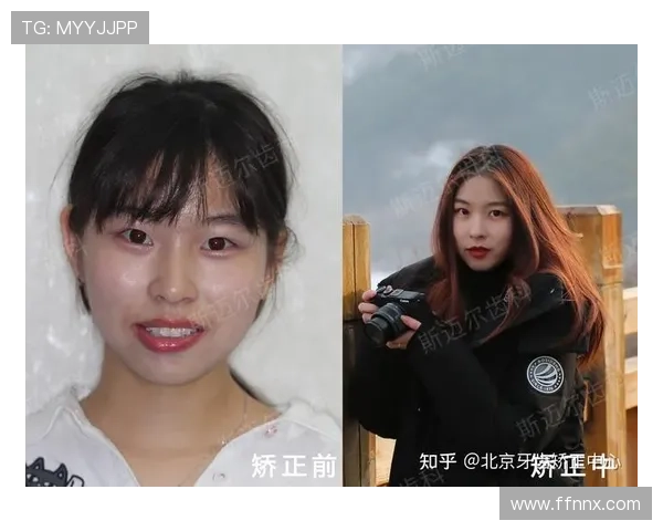 亚马尔自信分享戴牙套体验称其外观与自我形象完美契合